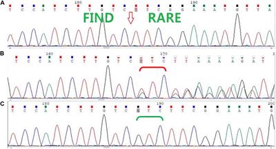 A deletion variant Arg616 of androgen receptor in a Chinese family with complete androgen insensitivity syndrome